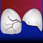 icon ToothSOS
